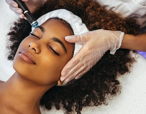 PRP Microneedling for Acne Scars