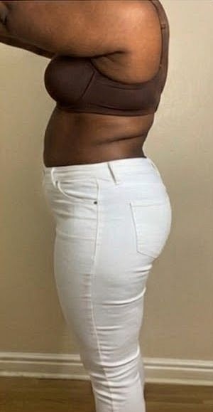 Weight Loss Before & After