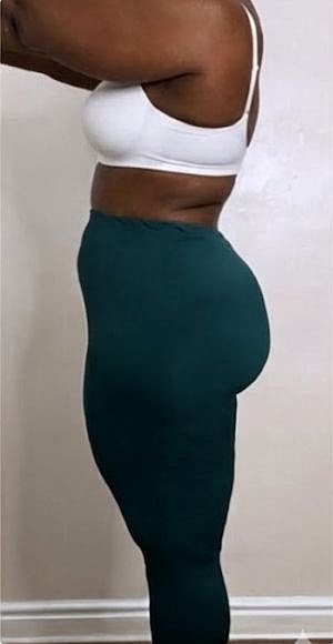 Weight Loss Before & After
