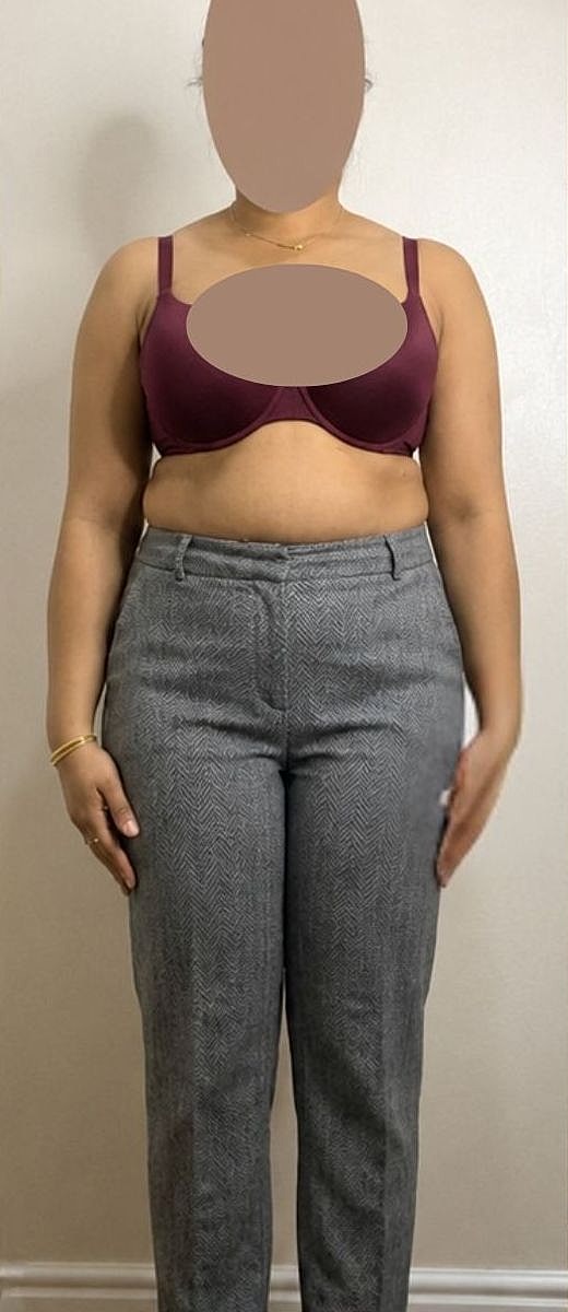 Weight Loss Before & After