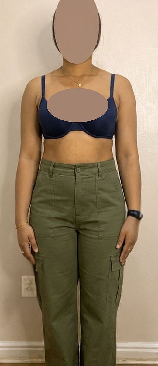 Weight Loss Before & After