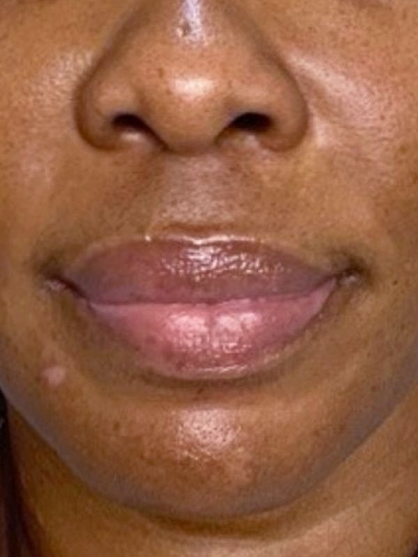 Close-up of lips and nose on skin.