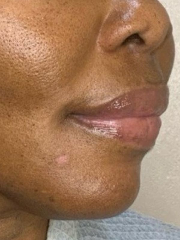 Close-up of smooth skin and lips.