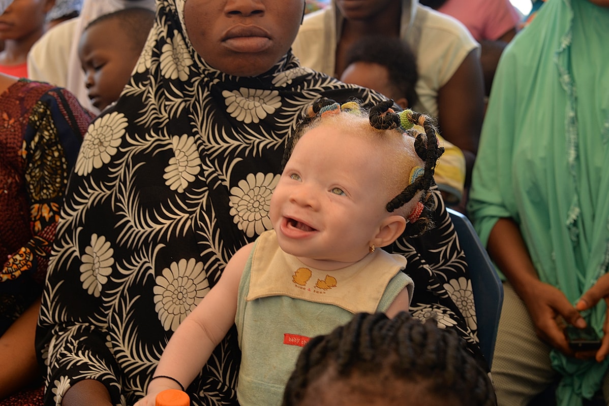 Smiling baby with colorful hair surrounded by adults.