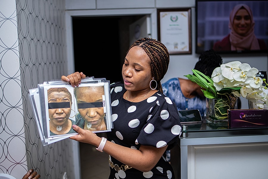 Woman showing before-and-after transformation photos.