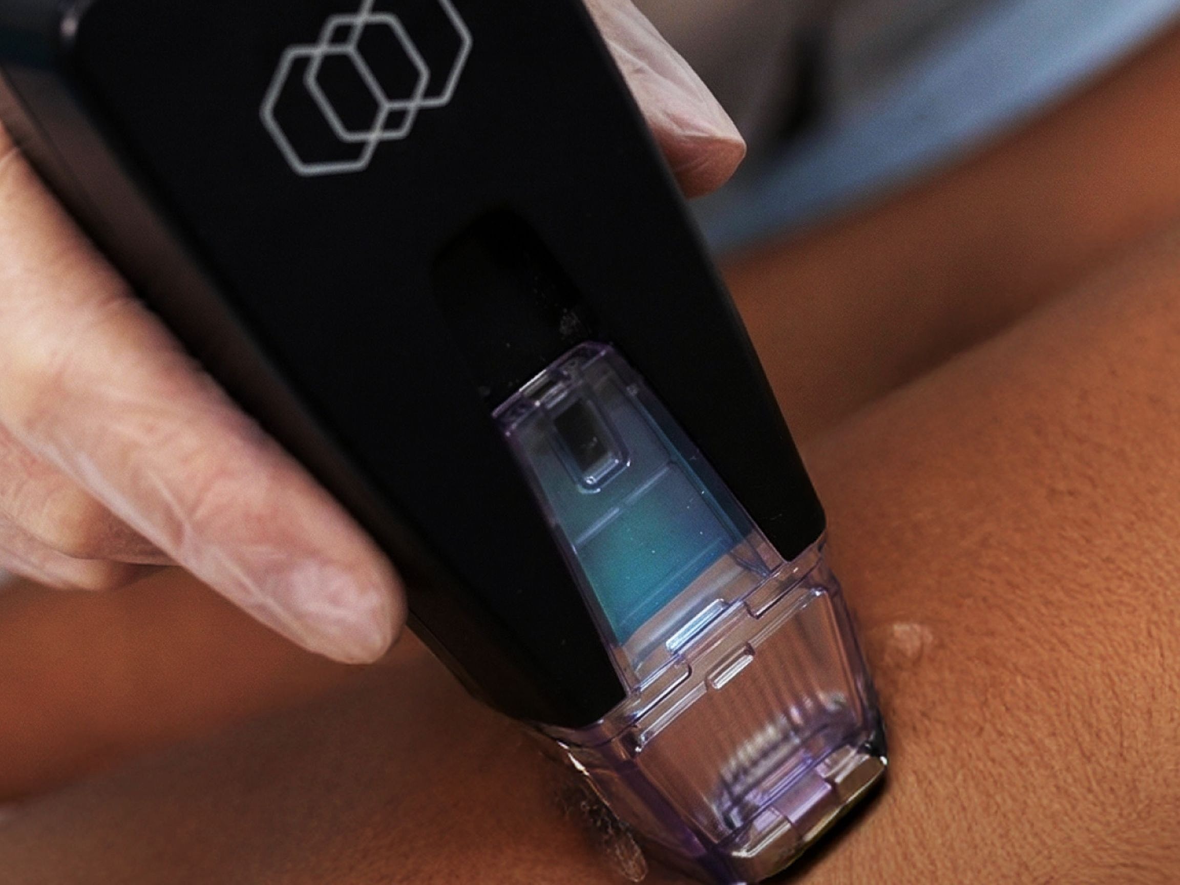 Skin treatment device in use on skin.